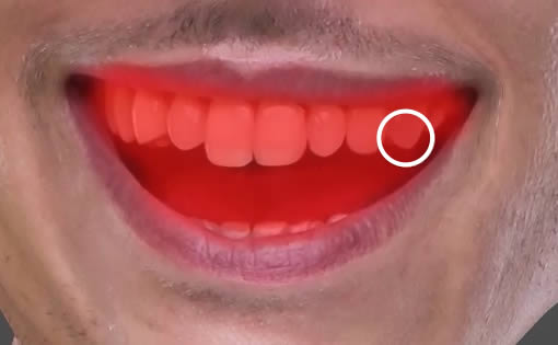 Mask teeth